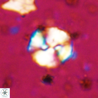 Watznaueria paenepelagicus VR 20265