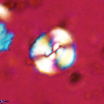 Watznaueria paenepelagicus VR 20266