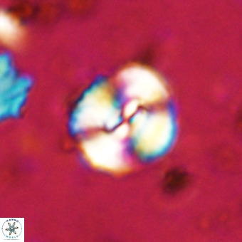 Watznaueria paenepelagicus VR 20266