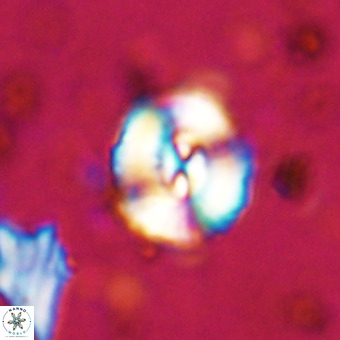 Watznaueria paenepelagicus VR 20269