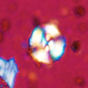 Watznaueria paenepelagicus VR 20271