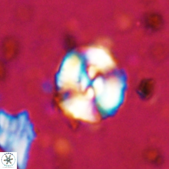 Watznaueria paenepelagicus VR 20271
