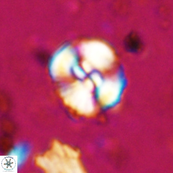 Watznaueria paenepelagicus VR 20272