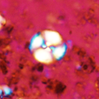 Watznaueria paenepelagicus VR 20203