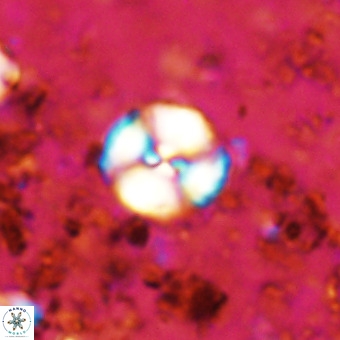 Watznaueria paenepelagicus VR 20203