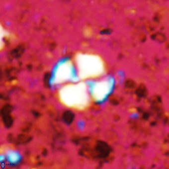 Watznaueria paenepelagicus VR 20205