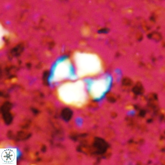 Watznaueria paenepelagicus VR 20205