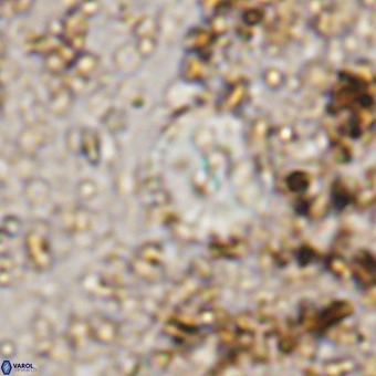 Watznaueria paenepelagicus VR 20208