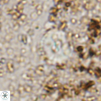 Watznaueria paenepelagicus VR 20208