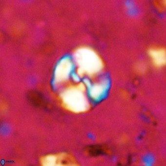 Watznaueria paenepelagicus VR 20392