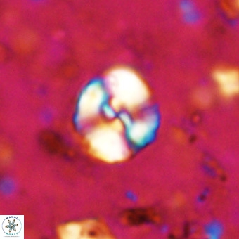 Watznaueria paenepelagicus VR 20392