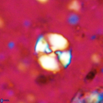 Watznaueria paenepelagicus VR 20393