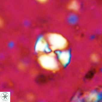 Watznaueria paenepelagicus VR 20393