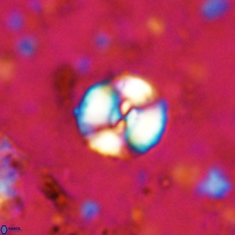 Watznaueria paenepelagicus VR 20396