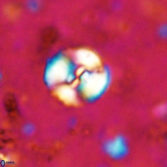 Watznaueria paenepelagicus VR 20397