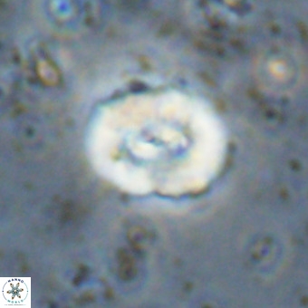 Watznaueria paenepelagicus VR 20479