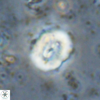 Watznaueria paenepelagicus VR 20480