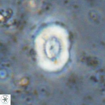 Watznaueria paenepelagicus VR 20481
