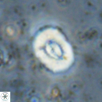 Watznaueria paenepelagicus VR 20482