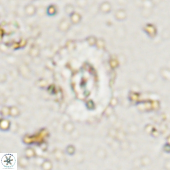 Watznaueria paenepelagicus VR 20485