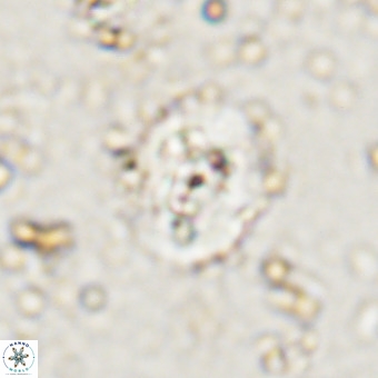 Watznaueria paenepelagicus VR 20487