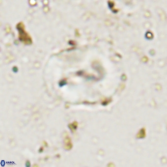 Watznaueria paenepelagicus VR 20490