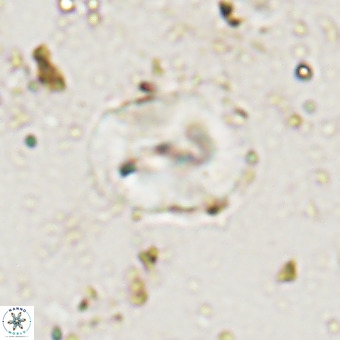 Watznaueria paenepelagicus VR 20490