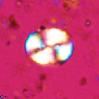 Watznaueria paenepelagicus VR 20492