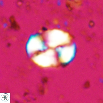 Watznaueria paenepelagicus VR 20492