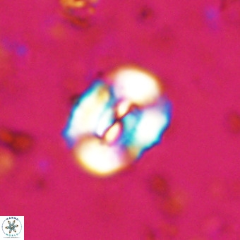 Watznaueria paenepelagicus VR 20494