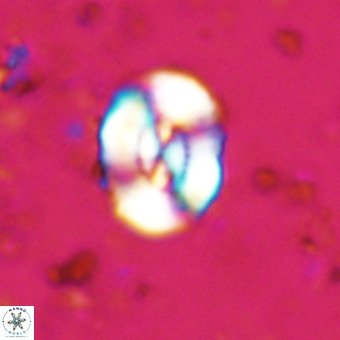 Watznaueria paenepelagicus VR 20497