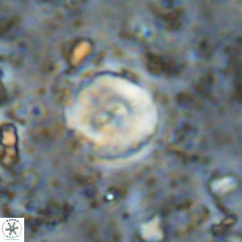 Watznaueria paenepelagicus VR 20407