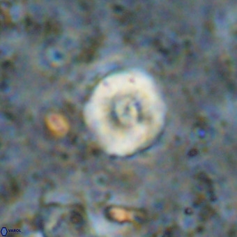 Watznaueria paenepelagicus VR 20411