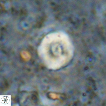 Watznaueria paenepelagicus VR 20411