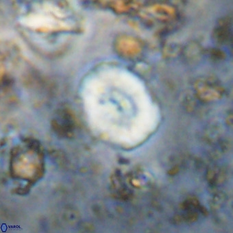 Watznaueria paenepelagicus VR 20593