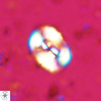 Watznaueria paenepelagicus VR 20501