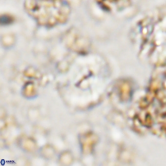 Watznaueria paenepelagicus VR 20600