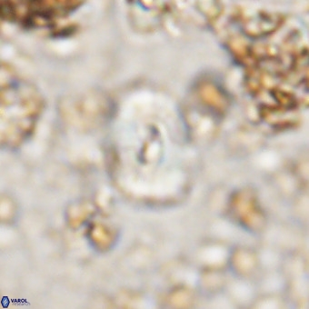 Watznaueria paenepelagicus VR 20602
