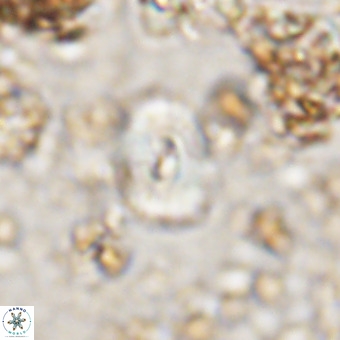 Watznaueria paenepelagicus VR 20602