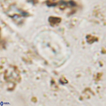 Watznaueria paenepelagicus VR 20603