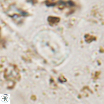 Watznaueria paenepelagicus VR 20603