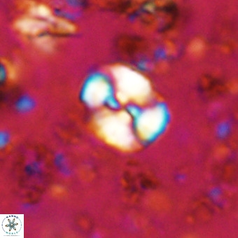 Watznaueria paenepelagicus VR 20605