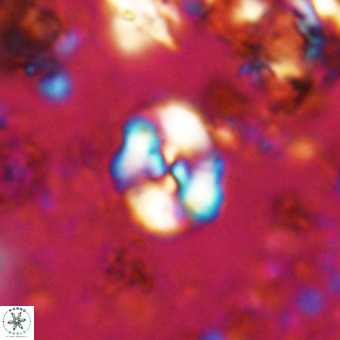 Watznaueria paenepelagicus VR 20606