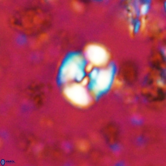Watznaueria paenepelagicus VR 20609