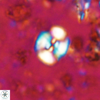 Watznaueria paenepelagicus VR 20609