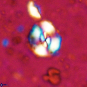 Watznaueria paenepelagicus VR 20740