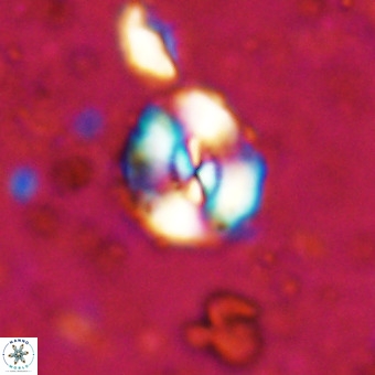 Watznaueria paenepelagicus VR 20740