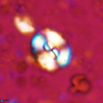 Watznaueria paenepelagicus VR 20741