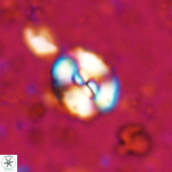 Watznaueria paenepelagicus VR 20741