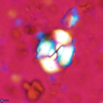 Watznaueria paenepelagicus VR 20748